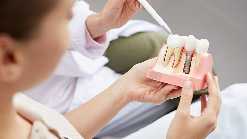 woman looking at model dental implant